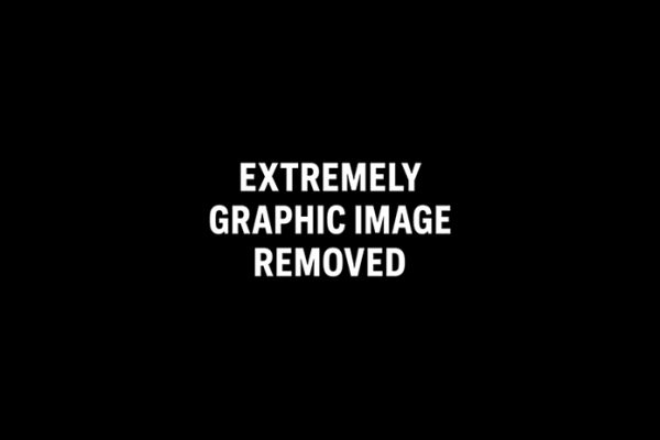 Graphic-Image-Removed-695